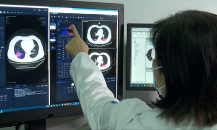 AI to facilitate fast diagnosis of COVID-19 pneumonia in Japan